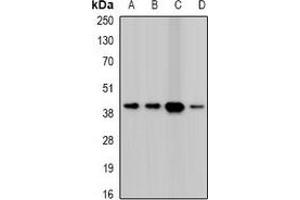 Western blot analysis of Twinfilin-2 expression in HepG2 (A), A431 (B), mouse heart (C), mouse spleen (D) whole cell lysates. (TWF2 抗体)
