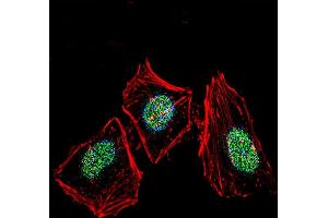 Fluorescent confocal image of Hela cell stained with XRCC6 Antibody (C-term) (ABIN651280 and ABIN2840167).