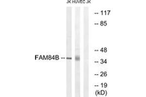 Western blot analysis of extracts from Jurkat/HuvEc cells, using FAM84B Antibody. (FAM84B 抗体  (AA 11-60))