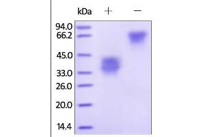 Human TWEAK R, Fc Tag on SDS-PAGE under reducing (R) and no-reducing (NR) conditions. (TNFRSF12A Protein (AA 28-79) (Fc Tag))