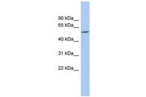 Image no. 1 for anti-Preferentially Expressed Antigen in Melanoma (PRAME) (N-Term) antibody (ABIN6743940) (PRAME 抗体  (N-Term))