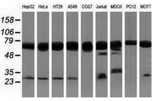 Western blot analysis of extracts (35 µg) from 9 different cell lines by using anti-PUS7 monoclonal antibody. (PUS7 抗体)