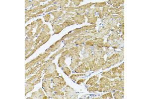 Immunohistochemistry of paraffin-embedded mouse heart using MT-CO3 antibody (ABIN7266636) at dilution of 1:100 (40x lens). (COX3 抗体)