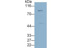 Detection of ANGPTL3 in HepG2 cell lysate using Polyclonal Antibody to Angiopoietin Like Protein 3 (ANGPTL3) (ANGPTL3 抗体  (AA 22-281))