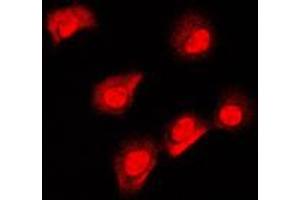 Immunofluorescence (IF) image for anti-Apoptosis-Inducing Factor, Mitochondrion-Associated, 1 (AIFM1) (N-Term) antibody (ABIN7297528)