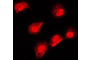 Immunofluorescent analysis of AIFM1 staining in MCF7 cells.