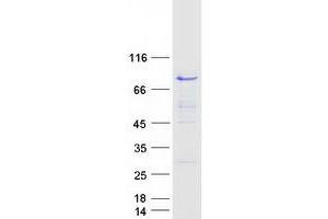 Western Blotting (WB) image for Nucleosome Assembly Protein 1-Like 2 (NAP1L2) protein (Myc-DYKDDDDK Tag) (ABIN2726804)