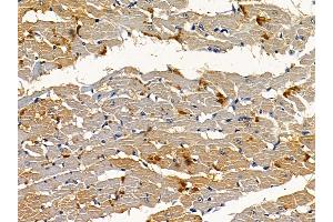 ABIN6256935 and ABIN6274838 at 1/100 staining rat heart tissue by IHC-P. (Amphiphysin 抗体  (Internal Region))
