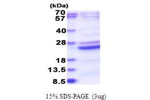 B9 Protein Domain 2 (B9D2) (AA 1-175) protein (His tag)