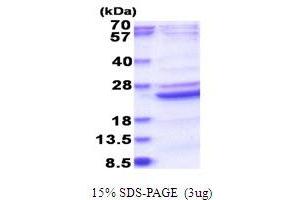 SDS-PAGE (SDS) image for B9 Protein Domain 2 (B9D2) (AA 1-175) protein (His tag) (ABIN6387463) (B9D2 Protein (AA 1-175) (His tag))