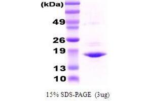 Figure annotation denotes ug of protein loaded and % gel used. (CRYAA 蛋白)