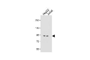 All lanes : Anti-MGAT5 Antibody (C-term) at 1:1000 dilution Lane 1: HepG2 whole cell lysate Lane 2: Jurkat whole cell lysate Lysates/proteins at 20 μg per lane. (MGAT5 抗体  (C-Term))