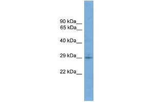 WB Suggested Anti-TMEM139 Antibody Titration: 0. (TMEM139 抗体  (N-Term))