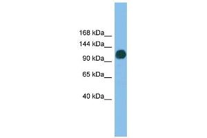 USP36 antibody used at 1 ug/ml to detect target protein. (USP36 抗体  (N-Term))
