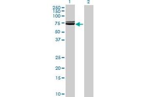 Western Blotting (WB) image for anti-Solute Carrier Family 39 (Metal Ion Transporter), Member 5 (SLC39A5) (AA 1-539) antibody (ABIN531525)
