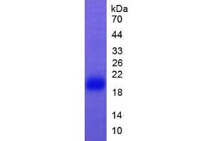 SDS-PAGE of Protein Standard from the Kit (Highly purified E. (FAS CLIA Kit)