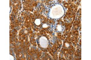 Immunohistochemistry (IHC) image for anti-Secretin Receptor (SCTR) antibody (ABIN3017416) (SCTR 抗体)