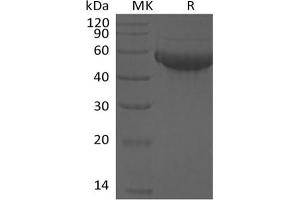 Western Blotting (WB) image for Sialic Acid Binding Ig-Like Lectin 8 (SIGLEC8) protein (His tag) (ABIN7319841)