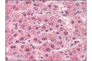 Immunohistochemistry (IHC) image for anti-Cathepsin L1 (CTSL1) (AA 114-333) antibody (ABIN317508) (Cathepsin L 抗体  (AA 114-333))