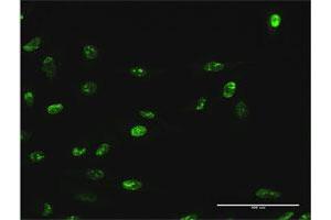 Immunofluorescence (IF) image for anti-WD Repeat Domain 18 (WDR18) (AA 1-432) antibody (ABIN949532)