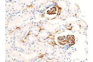 Immunohistochemistry (IHC) image for anti-Checkpoint Kinase 1 (CHEK1) (pSer301) antibody (ABIN6256255)