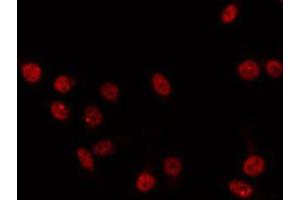 ABIN6266856 staining 293 by IF/ICC. (IRX2 抗体  (Internal Region))