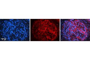 Rabbit Anti-C16ORF58 Antibody   Formalin Fixed Paraffin Embedded Tissue: Human Testis Tissue Observed Staining: Plasma membrane in spermatogonia and spermatocytes Primary Antibody Concentration: 1:100 Other Working Concentrations: N/A Secondary Antibody: Donkey anti-Rabbit-Cy3 Secondary Antibody Concentration: 1:200 Magnification: 20X Exposure Time: 0. (C16orf58 抗体  (N-Term))