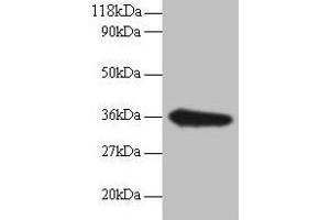 Western blot All lanes: TSTA3 antibody at 2 μg/mL + EC109 whole cell lysate Secondary Goat polyclonal to rabbit IgG at 1/15000 dilution Predicted band size: 36 kDa Observed band size: 36 kDa (TSTA3 抗体  (AA 1-314))