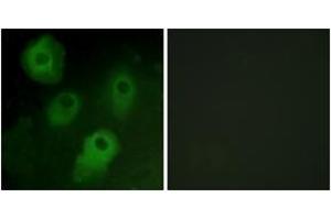 Immunofluorescence analysis of HeLa cells, using PKC delta (Ab-52) Antibody. (PKC delta 抗体  (AA 18-67))