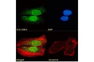 (ABIN185551) Immunofluorescence analysis of paraformaldehyde fixed U2OS cells, permeabilized with 0. (OGFR 抗体  (C-Term))