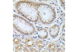 Immunohistochemistry of paraffin-embedded human stomach using CPM antibody (ABIN5975037) at dilution of 1/100 (40x lens). (CPM 抗体)