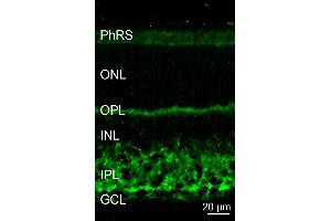 Indirect immunostaining of a PFA fixed mouse retina section (dilution 1 : 5000). (Dynamin 3 抗体  (AA 773-794))