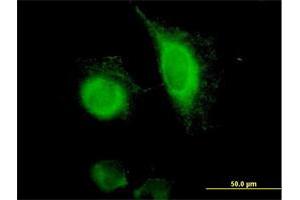 Immunofluorescence (IF) image for anti-Epithelial Cell Adhesion Molecule (EPCAM) (AA 1-314) antibody (ABIN517595)