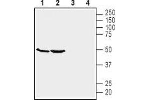 Western blot analysis of mouse kidney (lanes 1 and 3) and brain (lanes 2 and 4) lysates: - 1,2 Anti-GPR39 (extracellular) Antibody (ABIN7043159, ABIN7044429 and ABIN7044430), (1:200). (GPR39 抗体  (Extracellular))