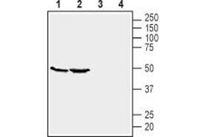 Western blot analysis of mouse kidney (lanes 1 and 3) and brain (lanes 2 and 4) lysates: - 1,2 Anti-GPR39 (extracellular) Antibody (ABIN7043159, ABIN7044429 and ABIN7044430), (1:200). (GPR39 抗体  (3rd Extracellular Loop))