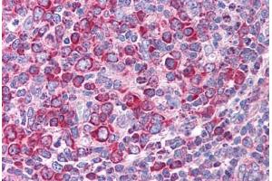Human Tonsil (formalin-fixed, paraffin-embedded) stained with LEF1 antibody ABIN214792 at 5 ug/ml followed by biotinylated goat anti-rabbit IgG secondary antibody ABIN481713, alkaline phosphatase-streptavidin and chromogen. (LEF1 抗体  (AA 51-100))