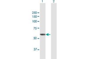 Western Blot analysis of ST7 expression in transfected 293T cell line by ST7 MaxPab polyclonal antibody. (ST7 抗体  (AA 1-547))