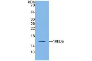 Western blot analysis of recombinant Mouse GLP1R. (GLP1R 抗体  (AA 25-145))
