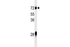 NOX3 antibody western blot analysis in mouse liver tissue lysate. (NOX3 抗体  (AA 73-102))