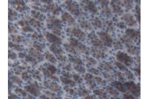 Immunohistochemistry (IHC) image for anti-Angiotensinogen (serpin Peptidase Inhibitor, Clade A, Member 8) (AGT) (AA 25-477) antibody (ABIN7426724)