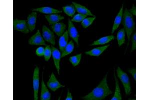 MCF7 cells were fixed with paraformaldehyde, permeabilized with 0. (PIK3R1 抗体)