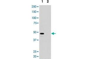 Western blot analysis of pre-incubated with (2) and without (1) blocking peptide in 293 cell lysate with MAGEA11 polyclonal antibody . (MAGEA11 抗体  (N-Term))