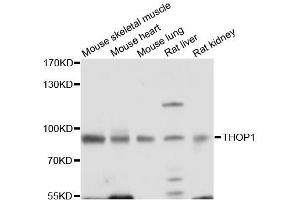 Western blot analysis of extracts of various cell lines, using THOP1 antibody (ABIN5996210) at 1/1000 dilution. (Thimet Oligopeptidase 1 抗体)