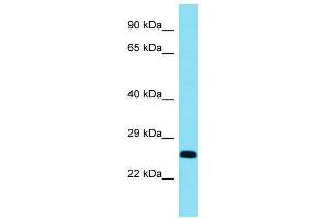 Host:  Rabbit  Target Name:  Bcl11a  Sample Type:  Mouse Heart lysates  Antibody Dilution:  1. (BCL11A 抗体  (C-Term))