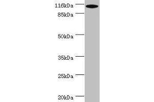 Western blot All lanes: MYO19 antibody at 2 μg/mL + A549 whole cell lysate Secondary Goat polyclonal to rabbit IgG at 1/10000 dilution Predicted band size: 110, 36, 72, 87 kDa Observed band size: 110 kDa