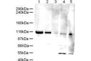 Western blot using  Affinity Purified anti-Elg1 antibody shows detection of a band ~120 kDa corresponding to human Elg1 (arrowhead) in various cell lysates. (ATAD5 抗体  (AA 63-76))