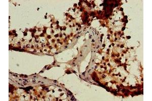 Immunohistochemistry of paraffin-embedded human testis tissue using ABIN7147659 at dilution of 1:100 (GCM2 抗体  (AA 156-451))