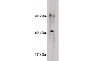 Image no. 2 for anti-serine Palmitoyltransferase, Long Chain Base Subunit 1 (SPTLC1) antibody (ABIN4620353) (SPTLC1 抗体)