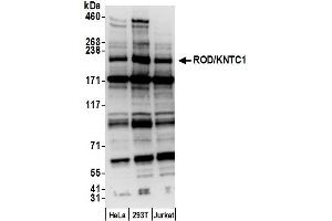 anti-Kinetochore Associated 1 (KNTC1) (AA 375-425) antibody