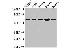 Western Blot Positive WB detected in: HEK293 whole cell lysate, A549 whole cell lysate, Mouse brain tissue, Mouse heart tissue, Rat brain tissue All lanes: PXK antibody at 2. (PXK 抗体  (AA 1-200))